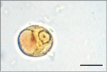 E. histolytica cyst 1
